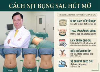 Hướng dẫn cách nịt bụng sau hút mỡ chuẩn y khoa từng bước